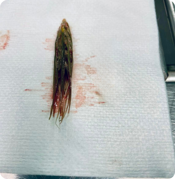 Spiga estratta endoscopicamente dal bronco destro Spiga rimossa con procedura endoscopica presso l’Ospedale Veterinario Santa Fara a Bari